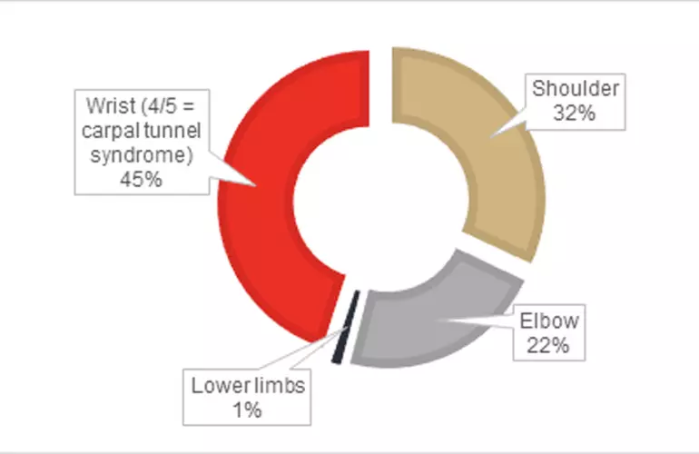 carpal tunnel syndrome